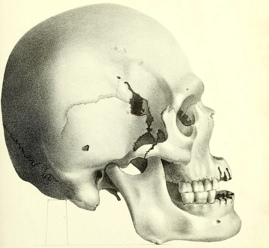 An illustration from Crania americana or, A comparative view of the skulls of various aboriginal nations of North and South America : to which is prefixed an essay on the varities of the human species / by Samuel George Morton., 1839, leaf 439