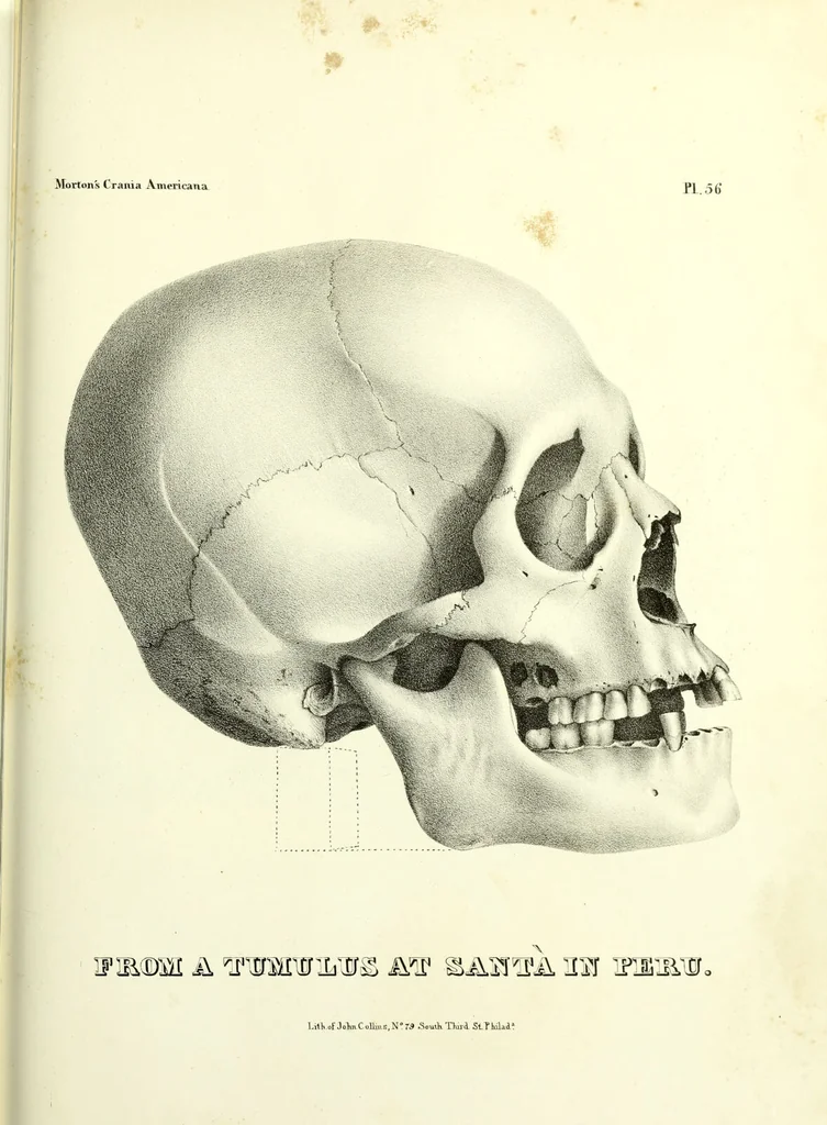 An illustration from Crania americana or, A comparative view of the skulls of various aboriginal nations of North and South America : to which is prefixed an essay on the varities of the human species / by Samuel George Morton., 1839, leaf 441