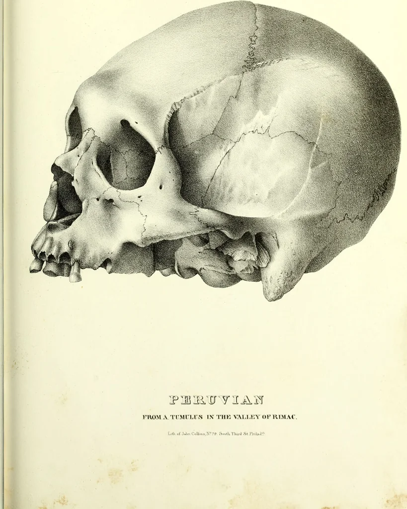 An illustration from Crania americana or, A comparative view of the skulls of various aboriginal nations of North and South America : to which is prefixed an essay on the varities of the human species / by Samuel George Morton., 1839, leaf 443