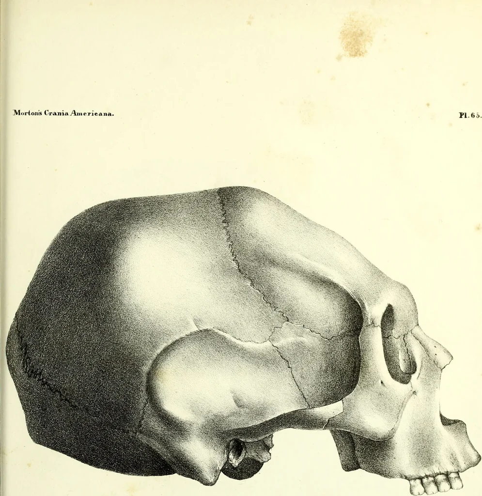 An illustration from Crania americana or, A comparative view of the skulls of various aboriginal nations of North and South America : to which is prefixed an essay on the varities of the human species / by Samuel George Morton., 1839, leaf 459