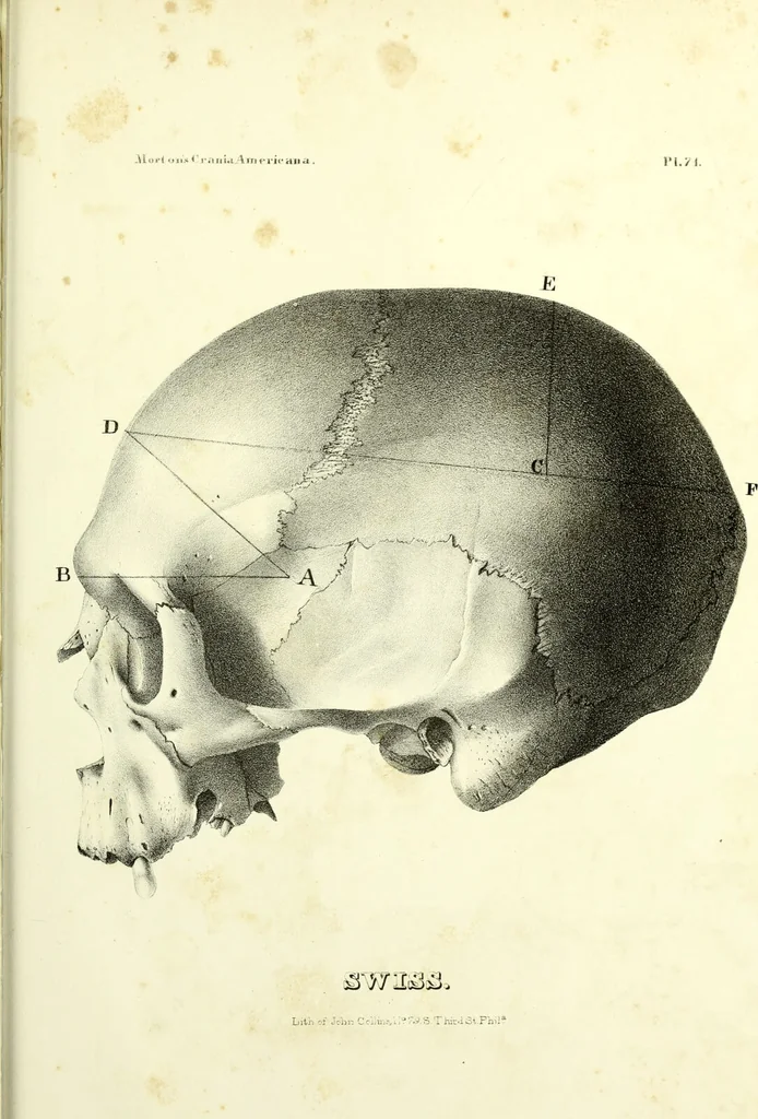 An illustration from Crania americana or, A comparative view of the skulls of various aboriginal nations of North and South America : to which is prefixed an essay on the varities of the human species / by Samuel George Morton., 1839, leaf 471