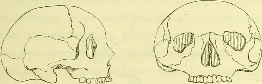 An illustration from Introduction a l'étude philosophique et pratique de la phrénologie., 1845, leaf 53