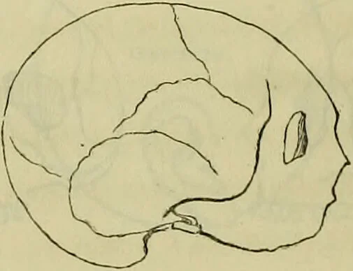 An illustration from Introduction a l'étude philosophique et pratique de la phrénologie., 1845, leaf 54