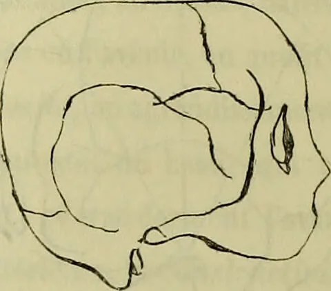An illustration from Introduction a l'étude philosophique et pratique de la phrénologie., 1845, leaf 72