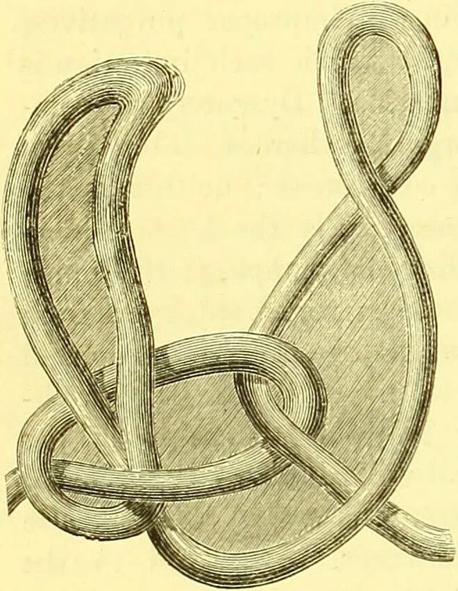 An illustration from Modern practical farriery : a complete guide to all that relates to the horse; its history, varieties, and uses, breaking, training, feeding, stabling, and grooming, how to buy, keep and treat a horse in health and disease ... forming a complete system of the veterinary art, as a present practised at the Royal Veterinary College, London / by W.J. Miles ... with numerous illustrations and a series of anatomical plates, engraved from the original drawings from nature, by Benjamin Herring. To which is added an essay on the diseases and management of cattle, sheep, and pigs / by J.I. Lupton., 1885, leaf 344