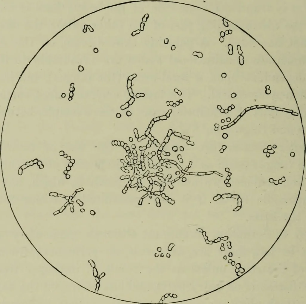 An illustration from A treatise on diseases of the skin with special reference to their diagnosis and treatment : including an analysis of 12,000 consecutive cases / Thomas McCall Anderson., 1894, leaf 594
