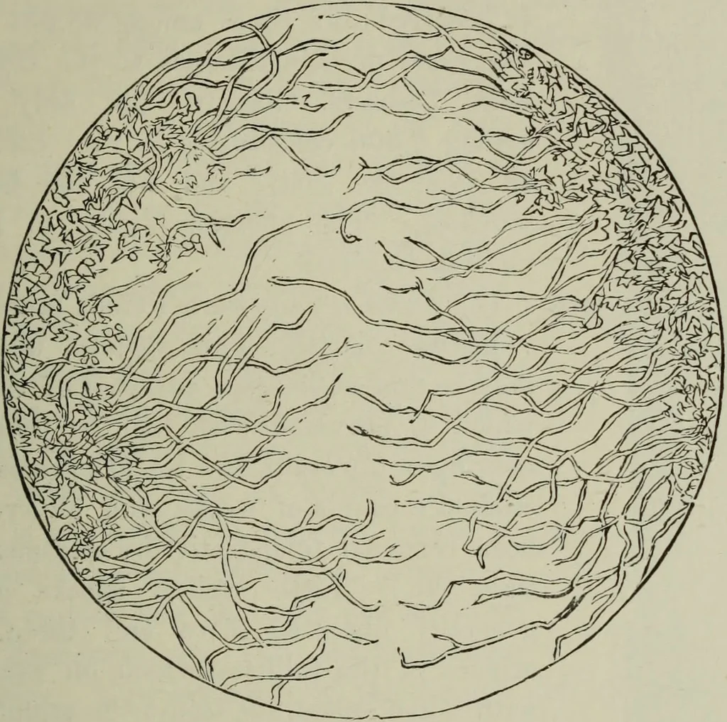An illustration from A treatise on diseases of the skin with special reference to their diagnosis and treatment : including an analysis of 12,000 consecutive cases / Thomas McCall Anderson., 1894, leaf 595