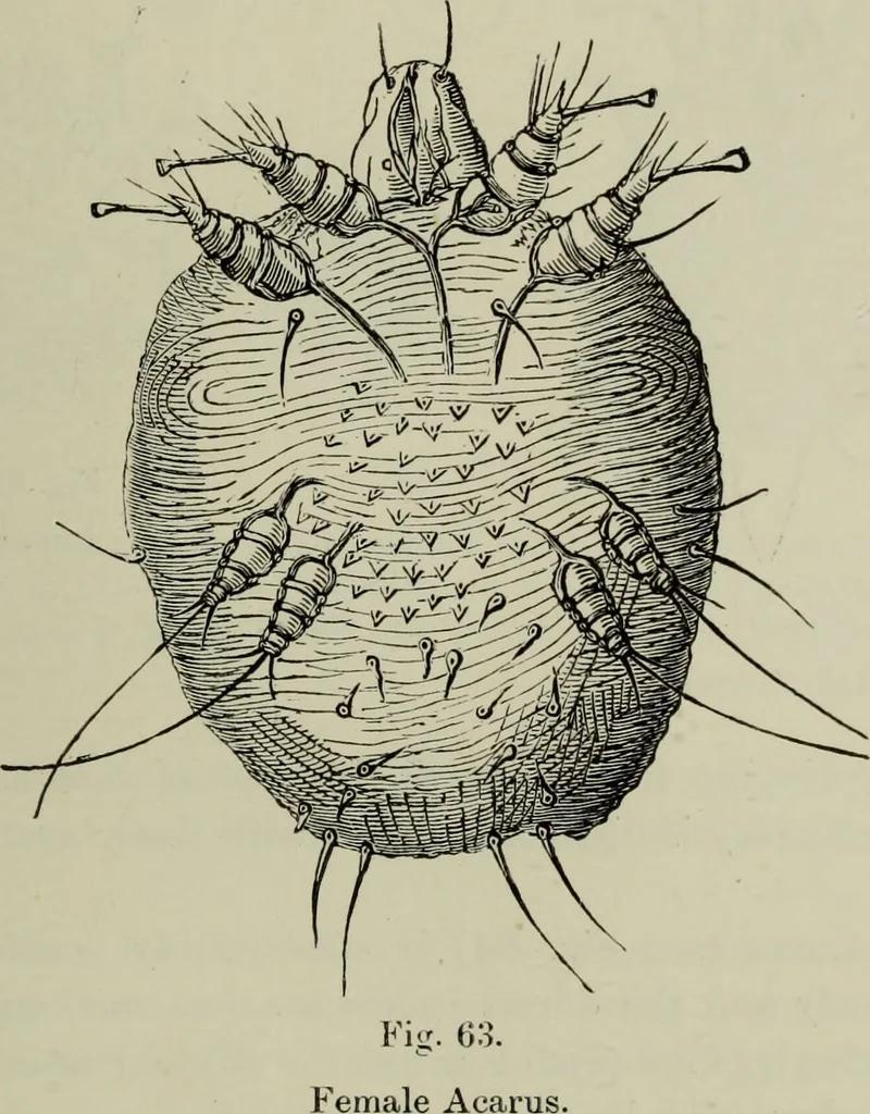 An illustration from A treatise on diseases of the skin with special reference to their diagnosis and treatment : including an analysis of 12,000 consecutive cases / Thomas McCall Anderson., 1894, leaf 651