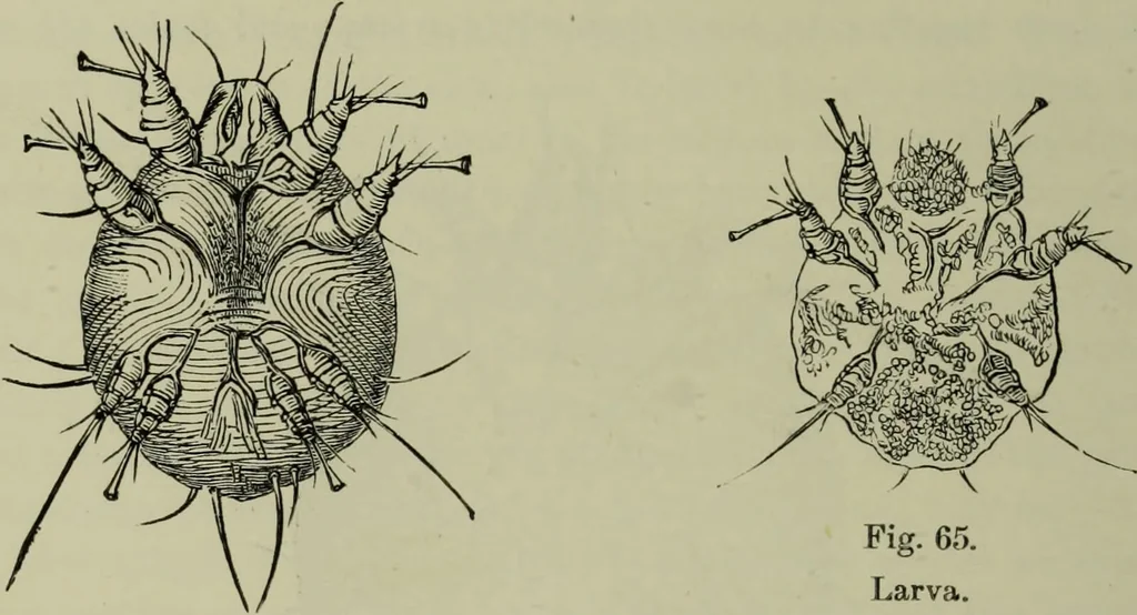 An illustration from A treatise on diseases of the skin with special reference to their diagnosis and treatment : including an analysis of 12,000 consecutive cases / Thomas McCall Anderson., 1894, leaf 652