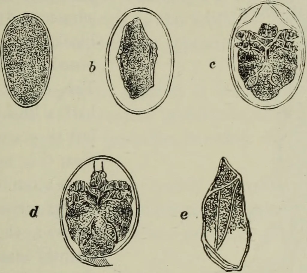 An illustration from A treatise on diseases of the skin with special reference to their diagnosis and treatment : including an analysis of 12,000 consecutive cases / Thomas McCall Anderson., 1894, leaf 653