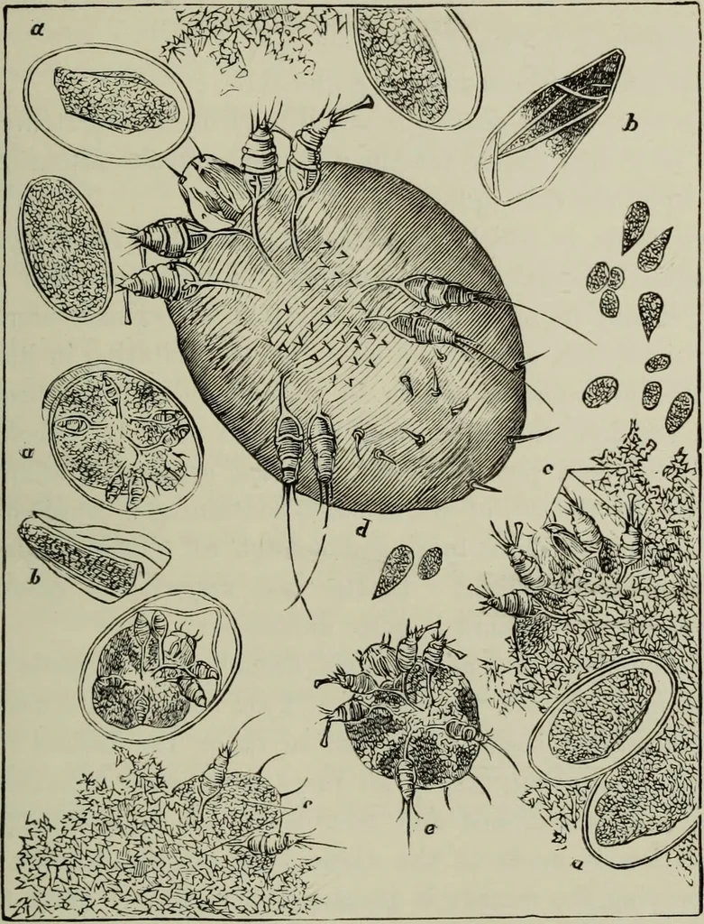 An illustration from A treatise on diseases of the skin with special reference to their diagnosis and treatment : including an analysis of 12,000 consecutive cases / Thomas McCall Anderson., 1894, leaf 657