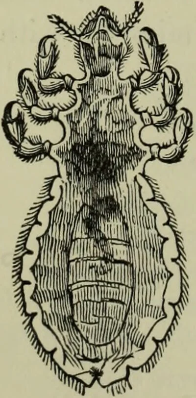 An illustration from A treatise on diseases of the skin with special reference to their diagnosis and treatment : including an analysis of 12,000 consecutive cases / Thomas McCall Anderson., 1894, leaf 662