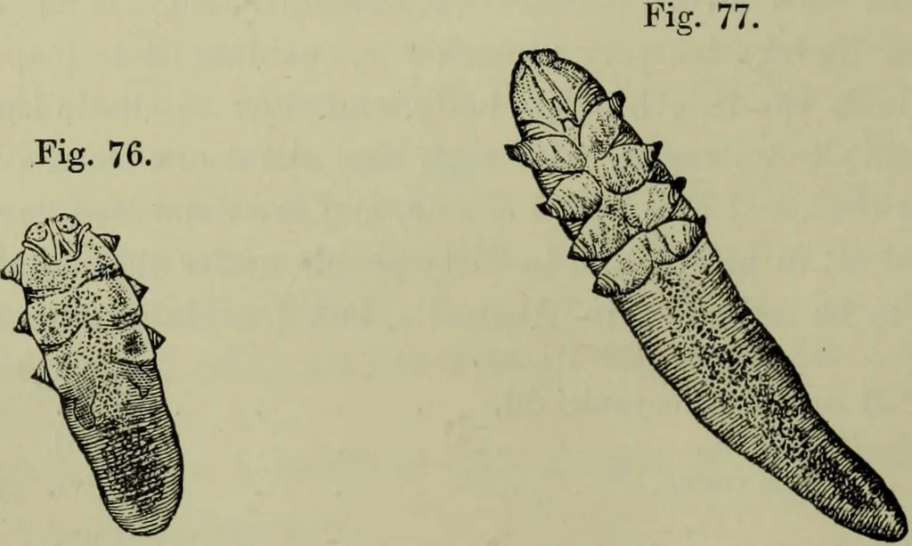 An illustration from A treatise on diseases of the skin with special reference to their diagnosis and treatment : including an analysis of 12,000 consecutive cases / Thomas McCall Anderson., 1894, leaf 674