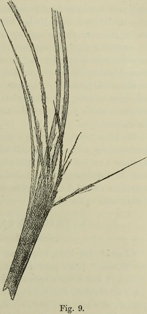 An illustration from A treatise on diseases of the skin with special reference to their diagnosis and treatment : including an analysis of 12,000 consecutive cases / Thomas McCall Anderson., 1894, leaf 93