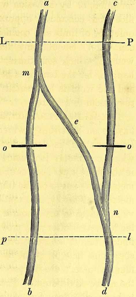 An illustration from Lameness in the horse : with coloured lithographic plates, illustrative of the different species of lameness. / By William Percivall, M.R.C.S., 1849, leaf 255