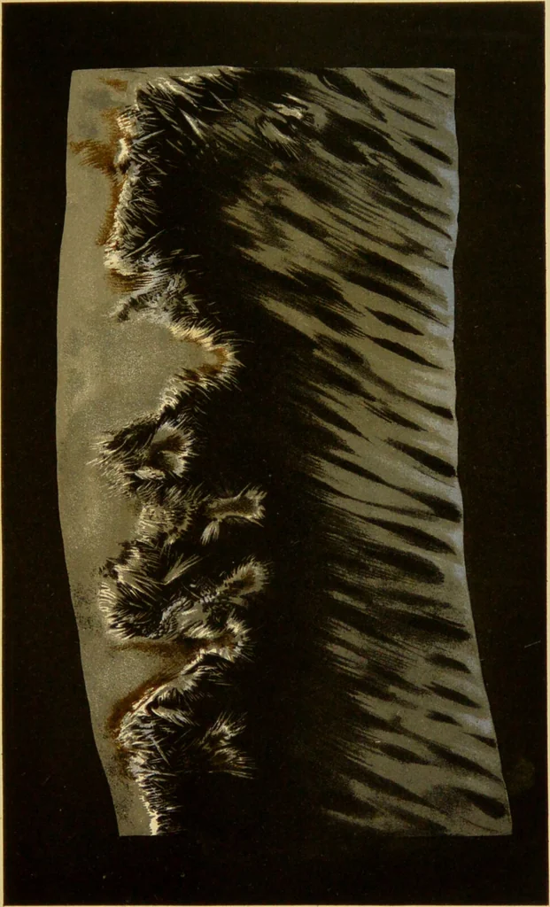 An illustration from La goutte : sa nature et son traitement / Dr W. Ebstein ... ; traduction de Dr E. Chambard ... ; introduction du Professeur Charcot ... ouvrage orné de 12 chromolithographies., 1887, leaf 247