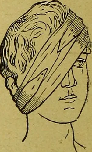 An illustration from La nuova medicina natural : trattato d'insegnamento e di consultazione sul metodo di curare e di guarire le malattie seguendo le leggi di natura / di F.E. Bilz., 1895, leaf 136