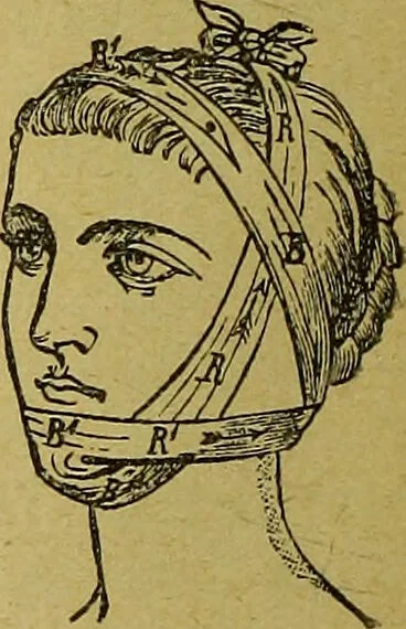 An illustration from La nuova medicina natural : trattato d'insegnamento e di consultazione sul metodo di curare e di guarire le malattie seguendo le leggi di natura / di F.E. Bilz., 1895, leaf 136