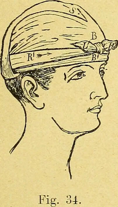 An illustration from La nuova medicina natural : trattato d'insegnamento e di consultazione sul metodo di curare e di guarire le malattie seguendo le leggi di natura / di F.E. Bilz., 1895, leaf 137
