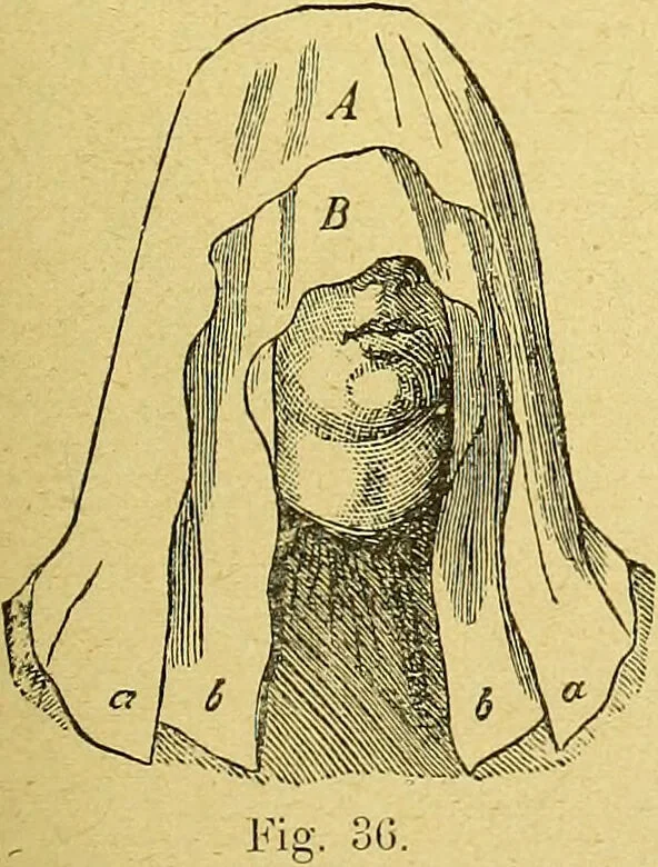 An illustration from La nuova medicina natural : trattato d'insegnamento e di consultazione sul metodo di curare e di guarire le malattie seguendo le leggi di natura / di F.E. Bilz., 1895, leaf 137