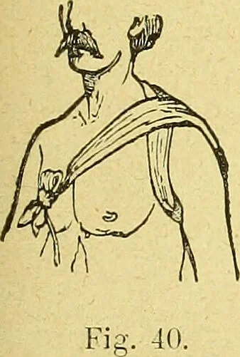 An illustration from La nuova medicina natural : trattato d'insegnamento e di consultazione sul metodo di curare e di guarire le malattie seguendo le leggi di natura / di F.E. Bilz., 1895, leaf 139