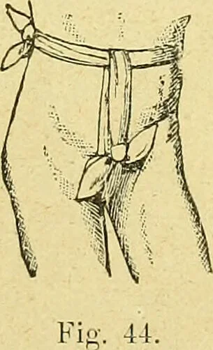 An illustration from La nuova medicina natural : trattato d'insegnamento e di consultazione sul metodo di curare e di guarire le malattie seguendo le leggi di natura / di F.E. Bilz., 1895, leaf 139