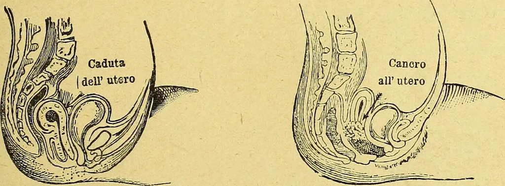 An illustration from La nuova medicina natural : trattato d'insegnamento e di consultazione sul metodo di curare e di guarire le malattie seguendo le leggi di natura / di F.E. Bilz., 1895, leaf 207