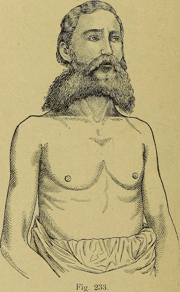 An illustration from La nuova medicina natural : trattato d'insegnamento e di consultazione sul metodo di curare e di guarire le malattie seguendo le leggi di natura / di F.E. Bilz., 1895, leaf 240