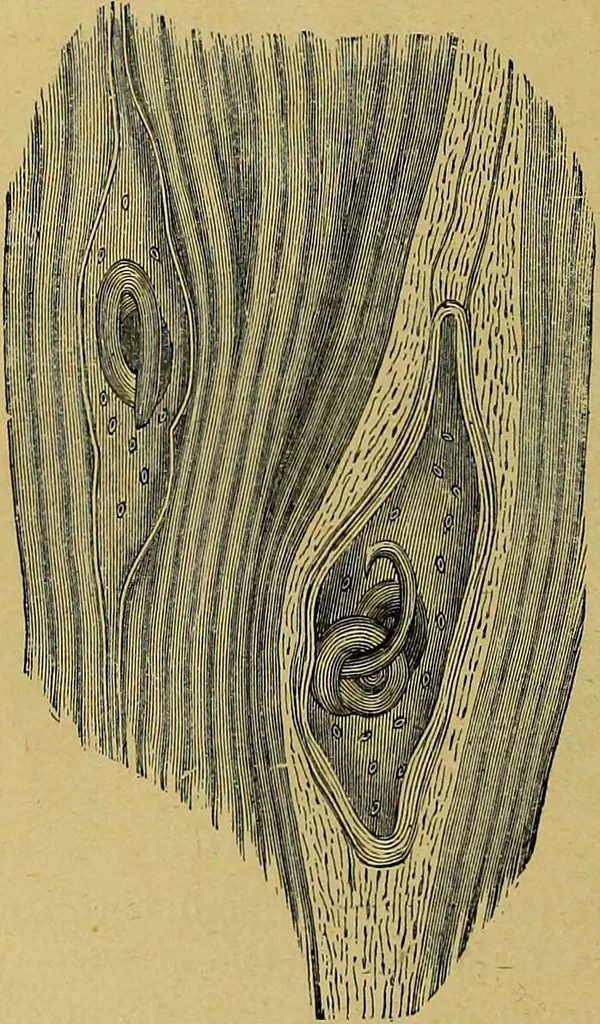 An illustration from La nuova medicina natural : trattato d'insegnamento e di consultazione sul metodo di curare e di guarire le malattie seguendo le leggi di natura / di F.E. Bilz., 1895, leaf 300