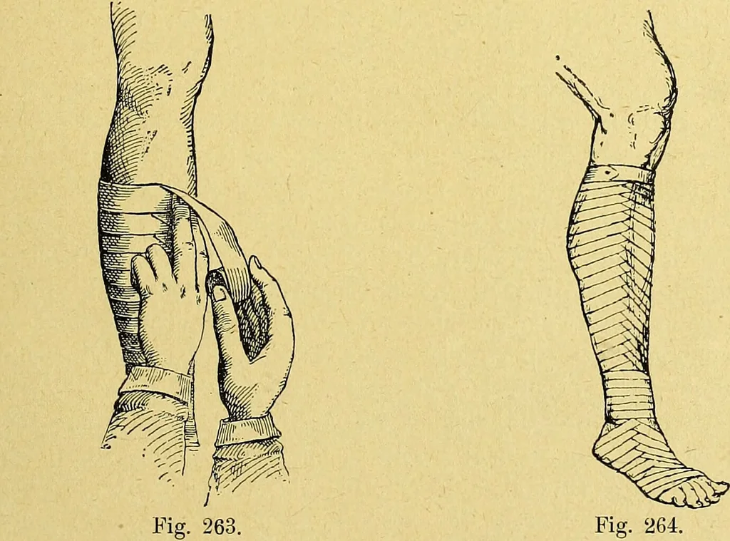 An illustration from La nuova medicina natural : trattato d'insegnamento e di consultazione sul metodo di curare e di guarire le malattie seguendo le leggi di natura / di F.E. Bilz., 1895, leaf 313