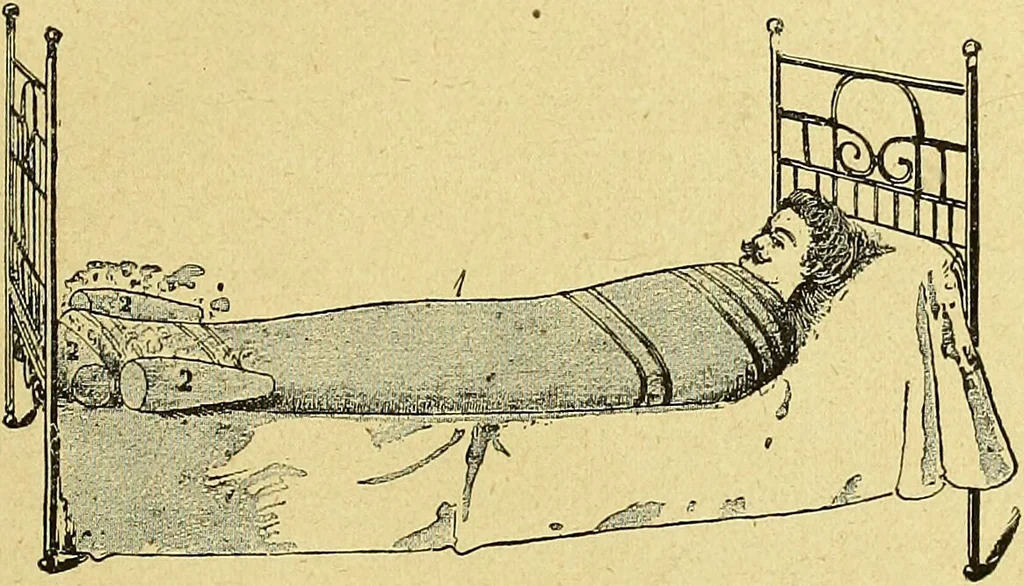 An illustration from La nuova medicina natural : trattato d'insegnamento e di consultazione sul metodo di curare e di guarire le malattie seguendo le leggi di natura / di F.E. Bilz., 1895, leaf 345