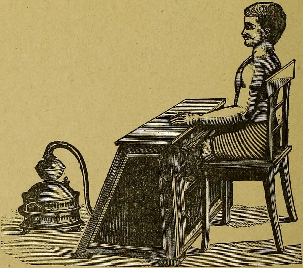 An illustration from La nuova medicina natural : trattato d'insegnamento e di consultazione sul metodo di curare e di guarire le malattie seguendo le leggi di natura / di F.E. Bilz., 1895, leaf 354