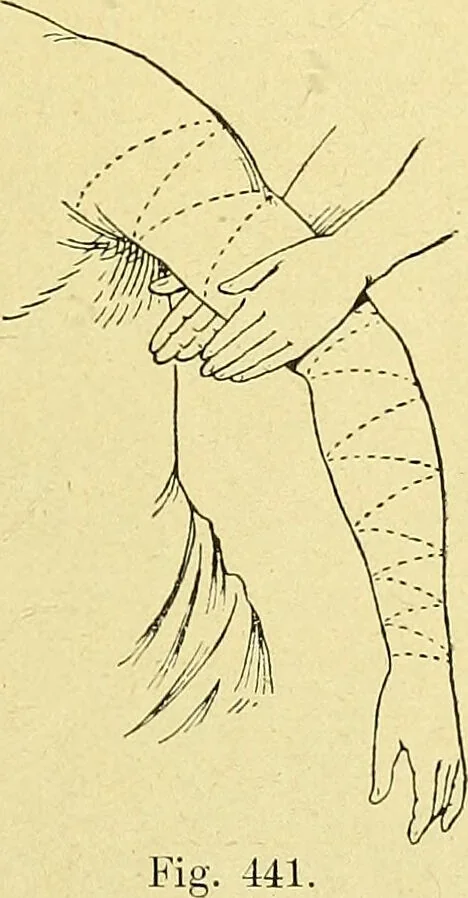 An illustration from La nuova medicina natural : trattato d'insegnamento e di consultazione sul metodo di curare e di guarire le malattie seguendo le leggi di natura / di F.E. Bilz., 1895, leaf 367