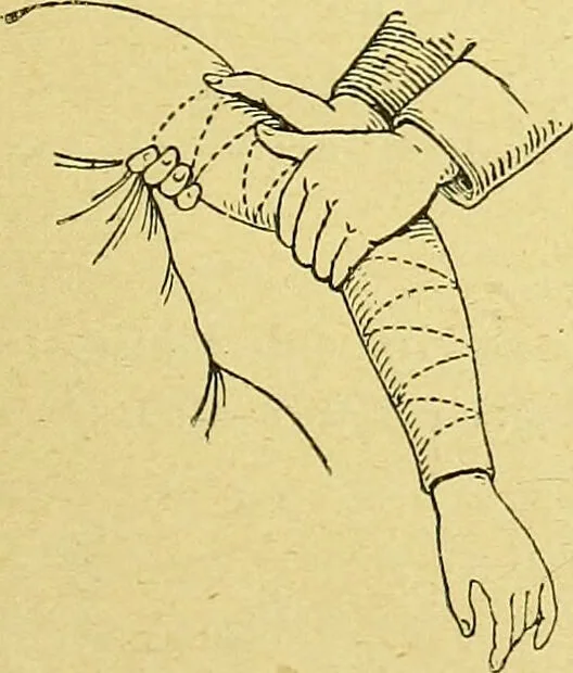 An illustration from La nuova medicina natural : trattato d'insegnamento e di consultazione sul metodo di curare e di guarire le malattie seguendo le leggi di natura / di F.E. Bilz., 1895, leaf 369