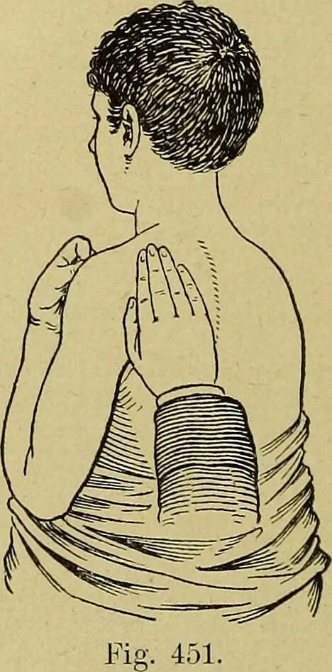 An illustration from La nuova medicina natural : trattato d'insegnamento e di consultazione sul metodo di curare e di guarire le malattie seguendo le leggi di natura / di F.E. Bilz., 1895, leaf 370