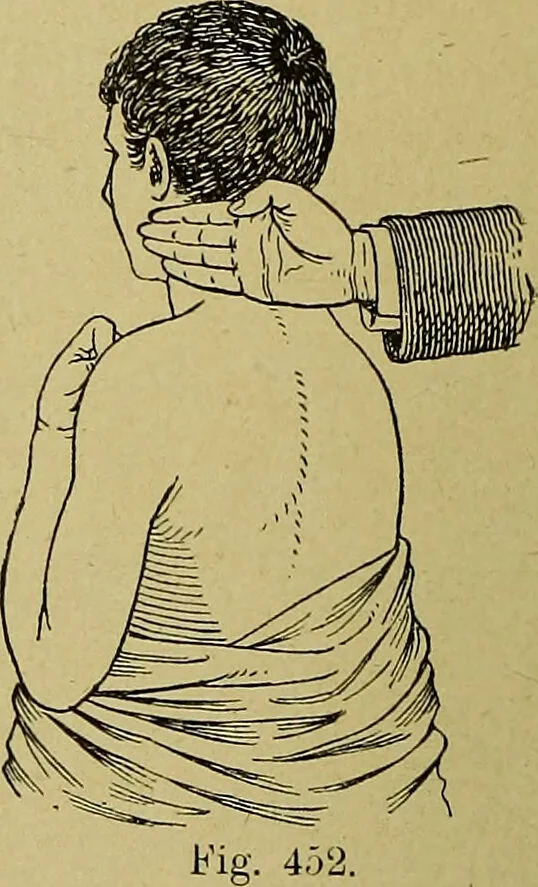 An illustration from La nuova medicina natural : trattato d'insegnamento e di consultazione sul metodo di curare e di guarire le malattie seguendo le leggi di natura / di F.E. Bilz., 1895, leaf 370