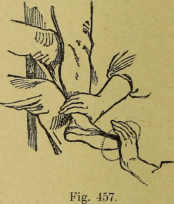 An illustration from La nuova medicina natural : trattato d'insegnamento e di consultazione sul metodo di curare e di guarire le malattie seguendo le leggi di natura / di F.E. Bilz., 1895, leaf 372