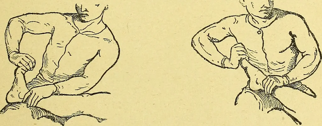 An illustration from La nuova medicina natural : trattato d'insegnamento e di consultazione sul metodo di curare e di guarire le malattie seguendo le leggi di natura / di F.E. Bilz., 1895, leaf 373