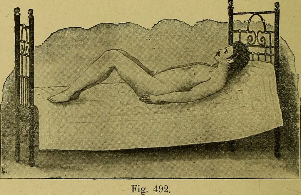An illustration from La nuova medicina natural : trattato d'insegnamento e di consultazione sul metodo di curare e di guarire le malattie seguendo le leggi di natura / di F.E. Bilz., 1895, leaf 380