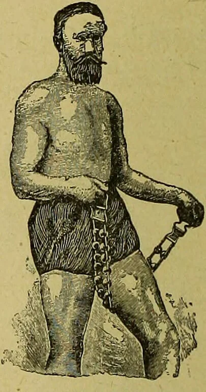 An illustration from La nuova medicina natural : trattato d'insegnamento e di consultazione sul metodo di curare e di guarire le malattie seguendo le leggi di natura / di F.E. Bilz., 1895, leaf 400