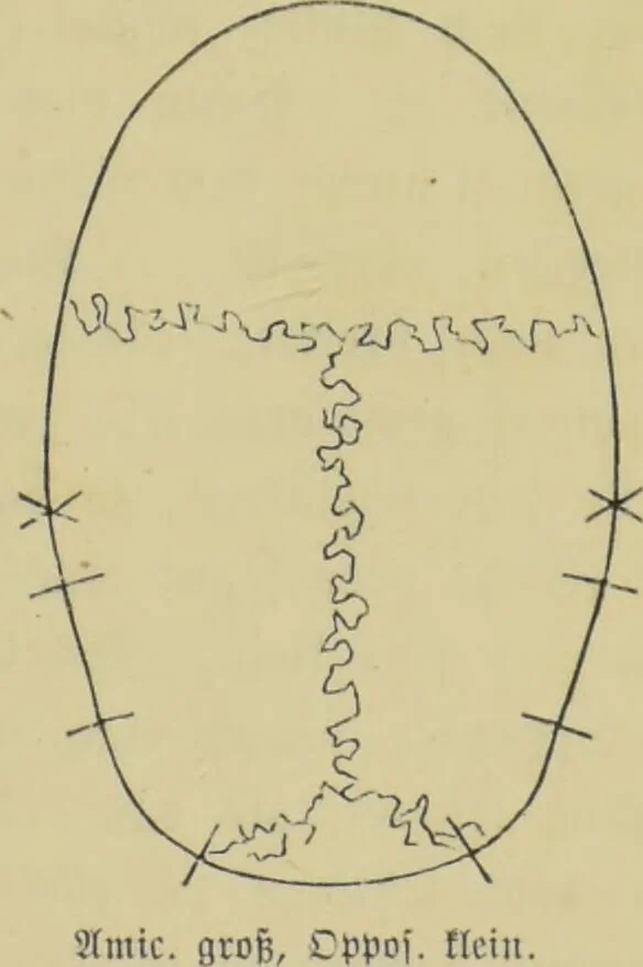 An illustration from Phrenologische Bilder : zur Naturlehre des menschlichen Geistes und deren Anwendung auf Wissenschaft und Leben auch zur Verständigung zwischen Phrenologie und Anthropologie / von Gustav Scheve., 1874, leaf 191