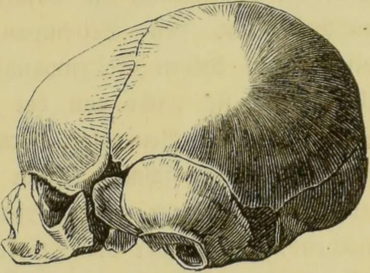 An illustration from Phrenologische Bilder : zur Naturlehre des menschlichen Geistes und deren Anwendung auf Wissenschaft und Leben auch zur Verständigung zwischen Phrenologie und Anthropologie / von Gustav Scheve., 1874, leaf 333