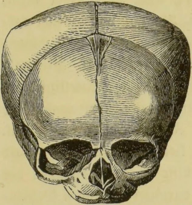 An illustration from Phrenologische Bilder : zur Naturlehre des menschlichen Geistes und deren Anwendung auf Wissenschaft und Leben auch zur Verständigung zwischen Phrenologie und Anthropologie / von Gustav Scheve., 1874, leaf 333