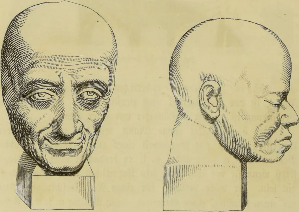 An illustration from Phrenologische Bilder : zur Naturlehre des menschlichen Geistes und deren Anwendung auf Wissenschaft und Leben auch zur Verständigung zwischen Phrenologie und Anthropologie / von Gustav Scheve., 1874, leaf 350
