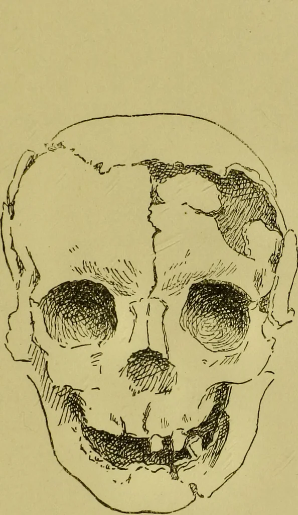 An illustration from Heads, and what they tell us : phrenological recollections / by W. Pugin Thornton., 1892, leaf 113