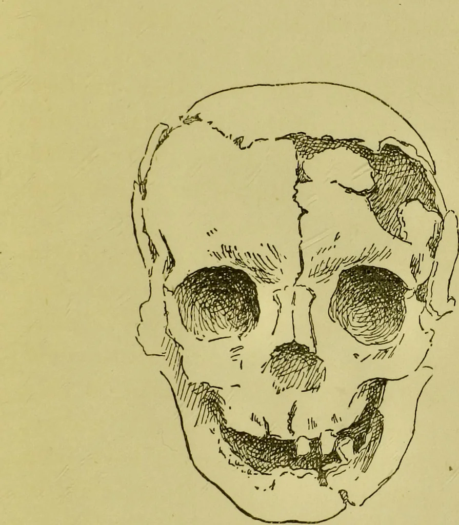 An illustration from Phrenology, or, Heads, and what they tell us / by W. Pugin Thornton., 1896, leaf 113