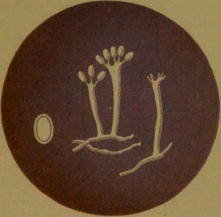 An illustration from Rust, smut, mildew & mould : An introduction to the study of microscopic fungi / by M. C. Cooke. Illustrated with 269 coloured figures, by J. E. Sowerby., 1886, leaf 193