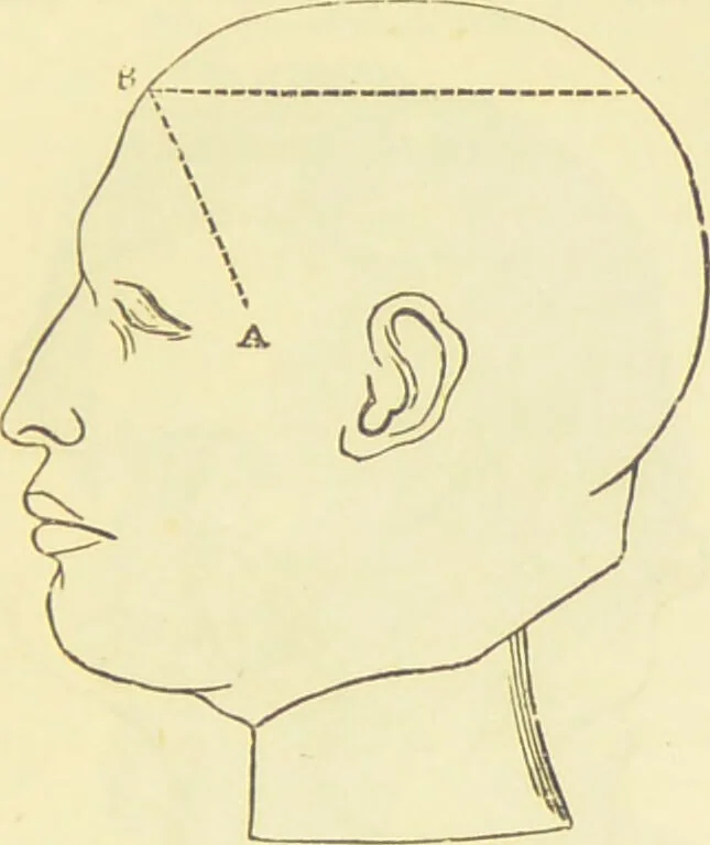 An illustration from The constitution of man considered in relation to external objects / [George Combe]., 1879, leaf 153