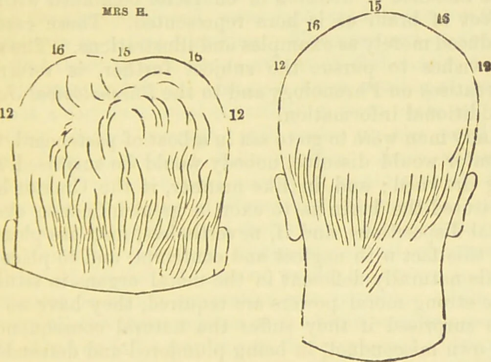 An illustration from The constitution of man considered in relation to external objects / [George Combe]., 1879, leaf 189