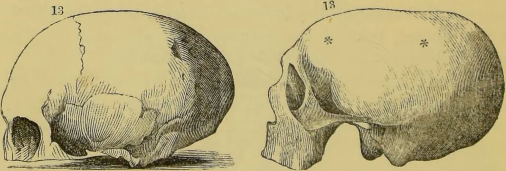 An illustration from Elements of phrenology / by George Combe., 1862, leaf 106